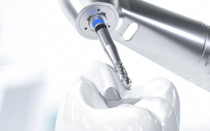 H4A - Amalgam Remover